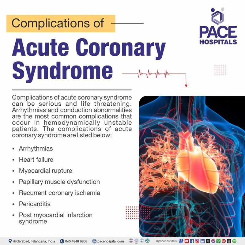 Acute coronary syndrome complications acute coronary syndrome complications | complications of acute coronary syndrome | What are the complications of acute coronary syndrome | Visual depicting the complications of acute coronary syndrome