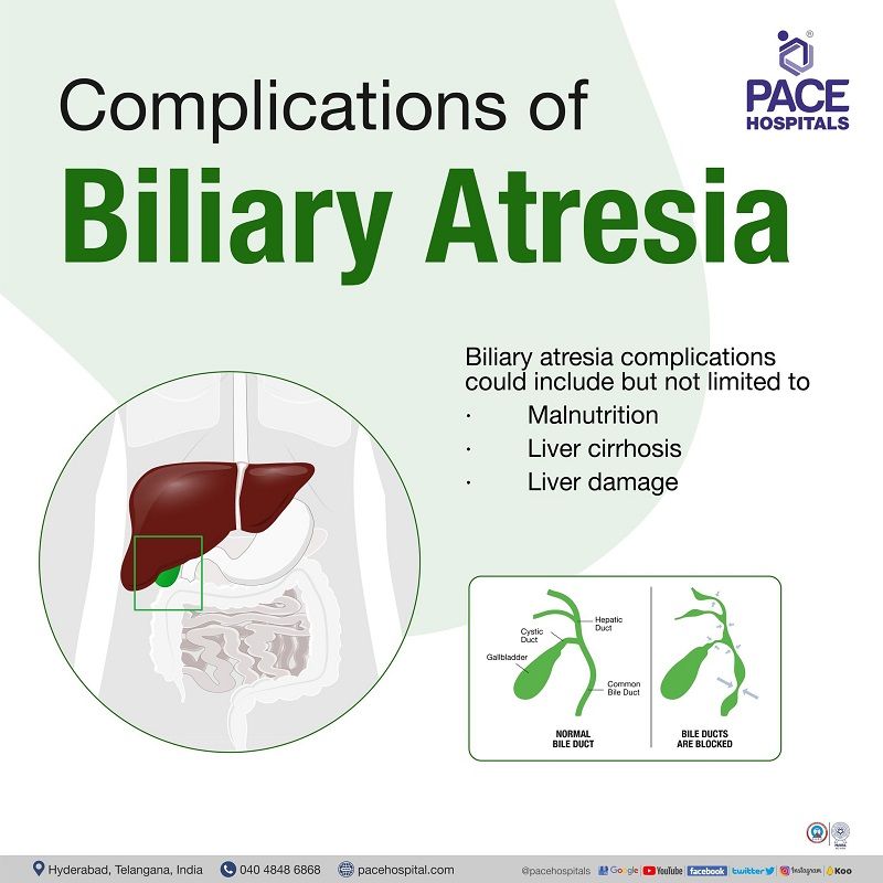 biliary atresia complications