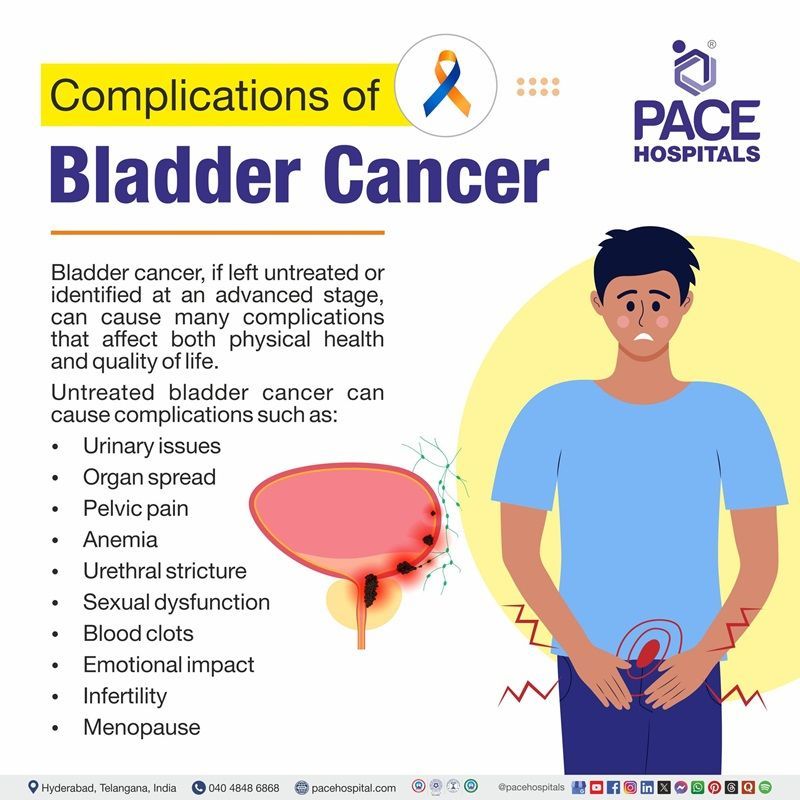 Complications of bladder cancer | image showing the complications of bladder cancer