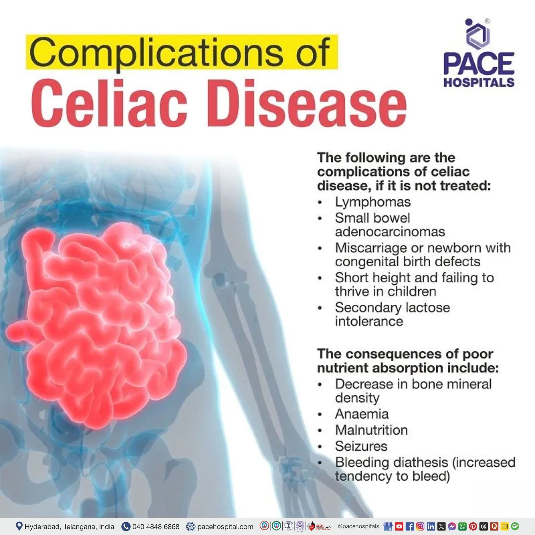 Complications of Celiac Disease Complications of Celiac Disease