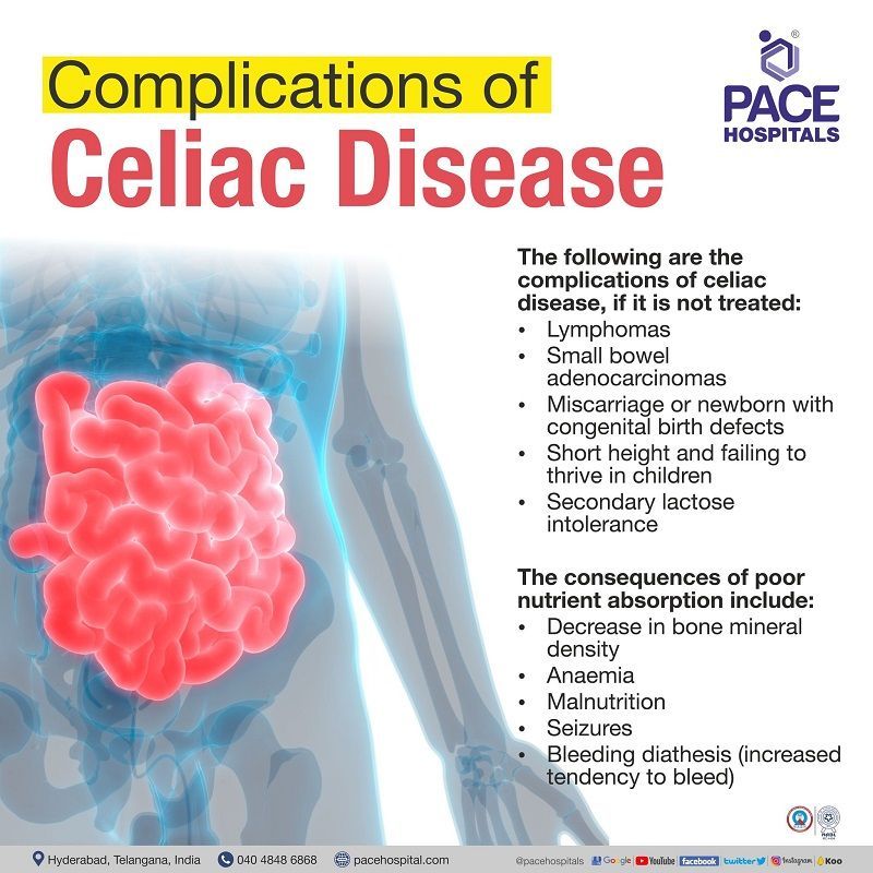 Complications of Celiac Disease