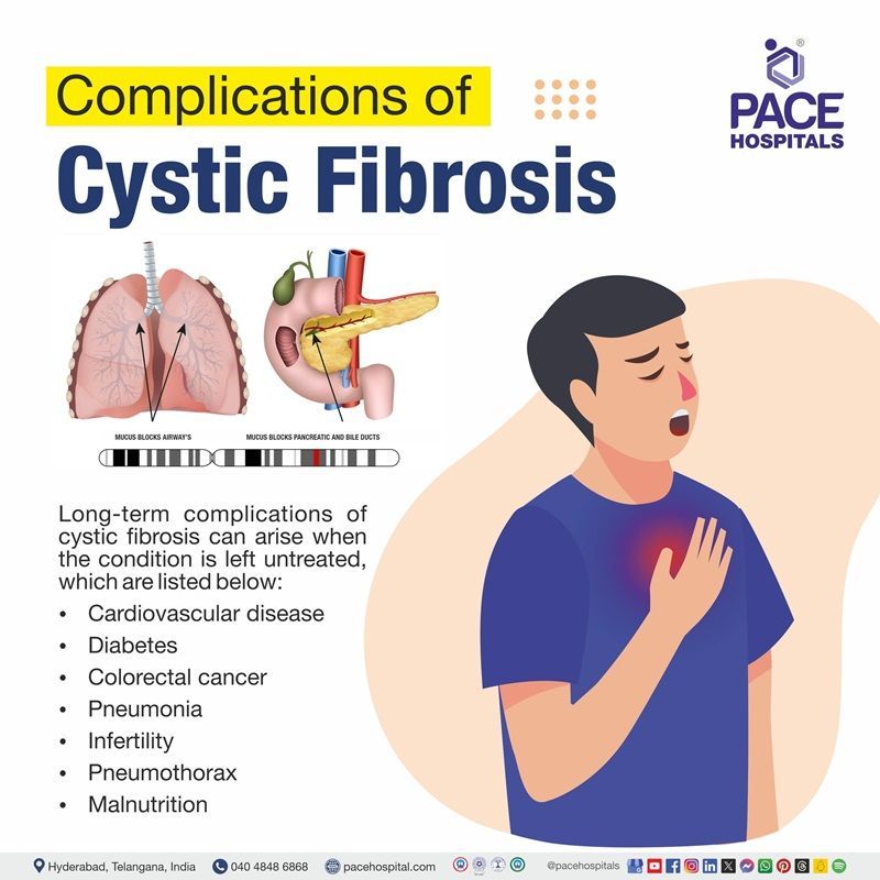 cystic fibrosis complications​ | what are the complications of cystic fibrosis​ | complications of cystic fibrosis​ | complications associated with cystic fibrosis​