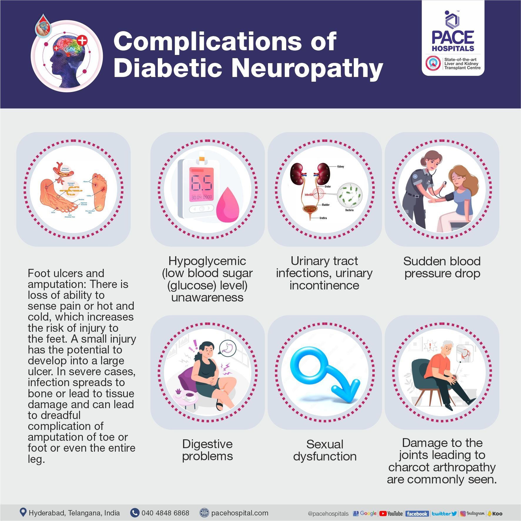 Complications of Diabetic Neuropathy