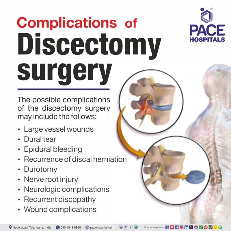 complications of Discectomy surgery​ or procedure