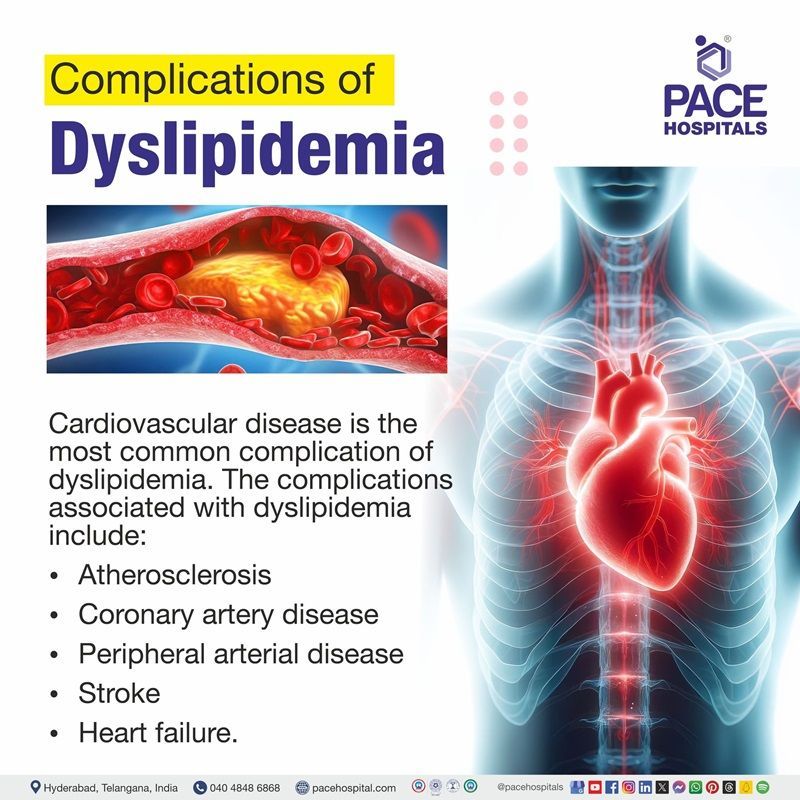 dyslipidemia complications | complications associated with dyslipidemia​ | the major complications of dyslipidemia​ | Complications of Dyslipidemia 
