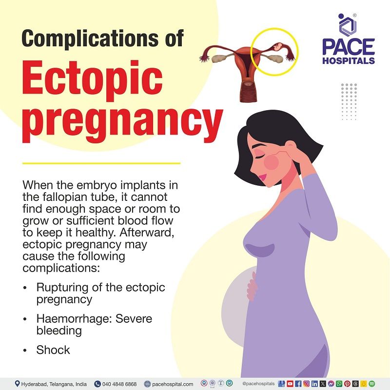 Ectopic pregnancy complications | complexities of Ectopic pregnancy | problems of ectopic pregnancy | woman with ectopic pregnancy complication | Ectopic pregnancy risks