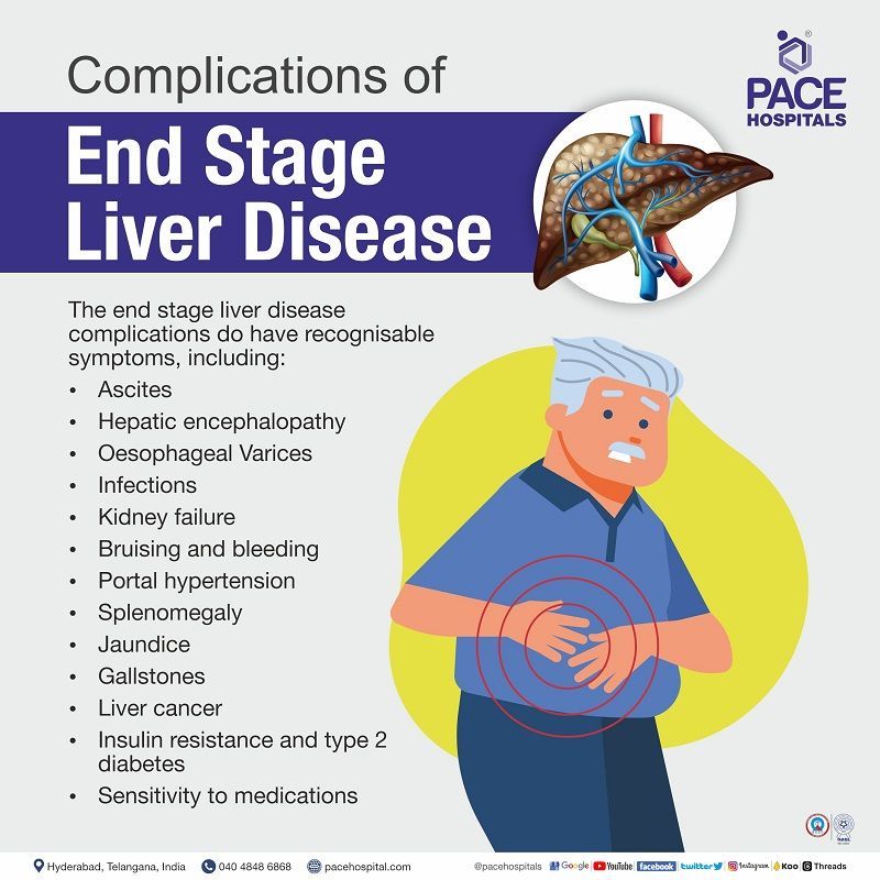 complications of end stage liver disease ESLD | end stage liver disease symptoms complications | end stage liver disease score