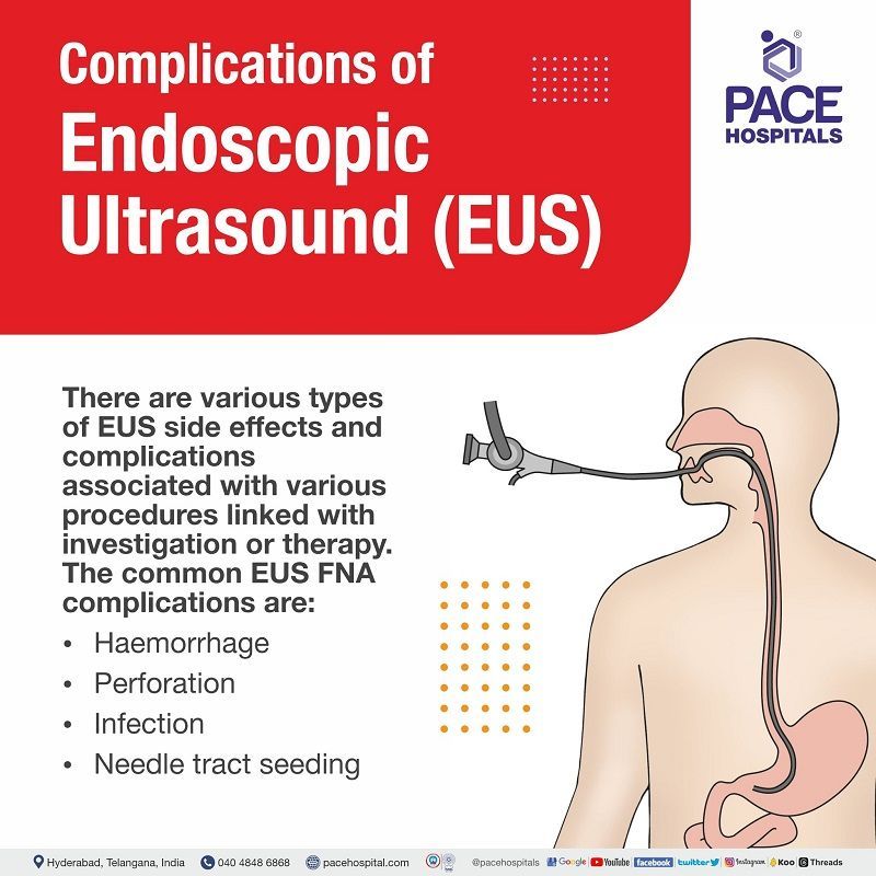 Endoscopic Ultrasound EUS side effects | complications
