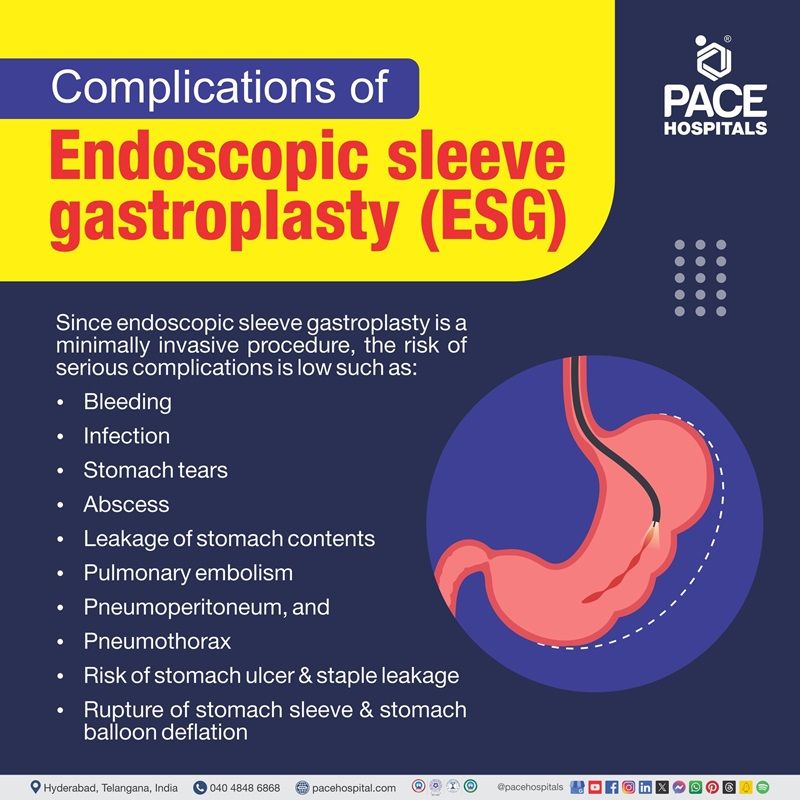 endoscopic sleeve gastroplasty side effects | ESG endoscopic sleeve gastroplasty complications | ESG endoscopic sleeve gastroplasty cost