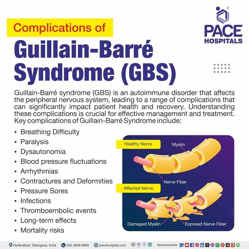 Guillain-Barré syndrome complications | image showing the complications of Guillain-Barré syndrome