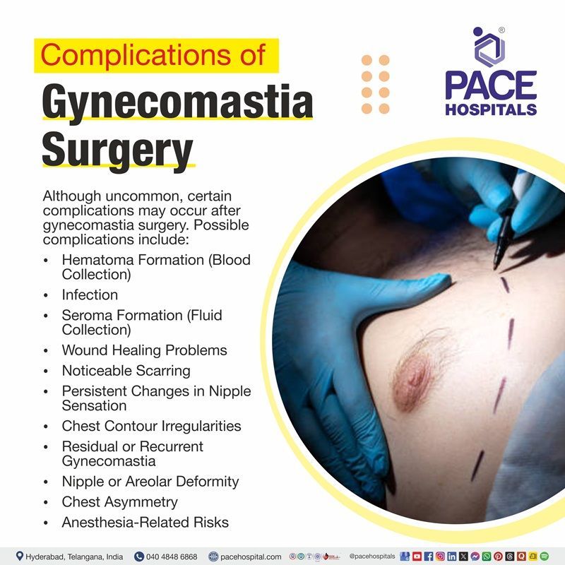 illustration depicting the complications and risks assocciated with Gynecomastia surgery