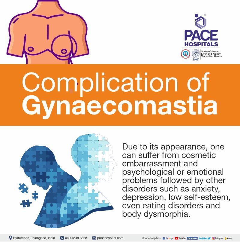 gynecomastia complications | gynaecomastia