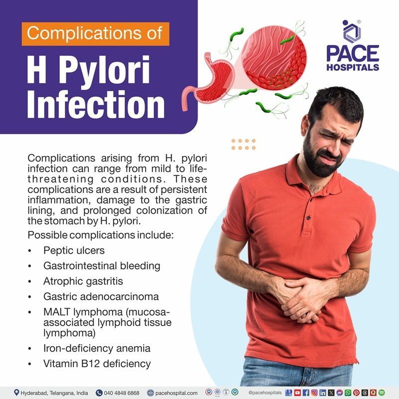 Complications of H. Pylori Infection Complications of H. pylori infection | h. pylori complications
