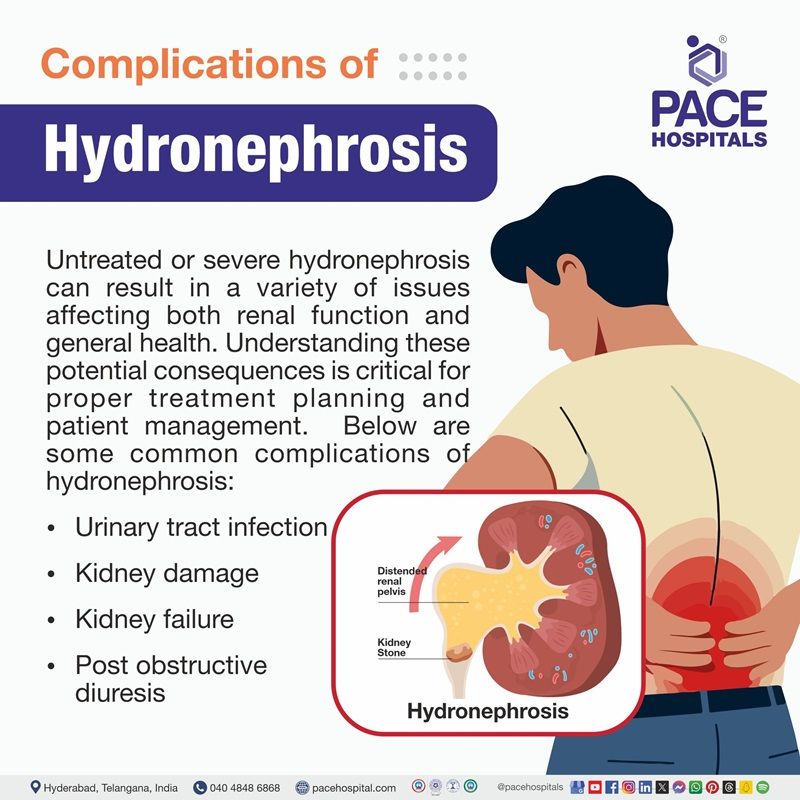 Complications of hydronephrosis | kidney hydronephrosis Complications