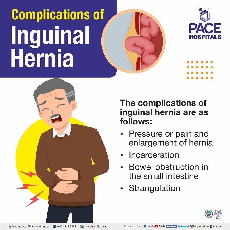 inguinal hernia complications if not treated | uncomplicated inguinal hernia | complications of direct inguinal hernia