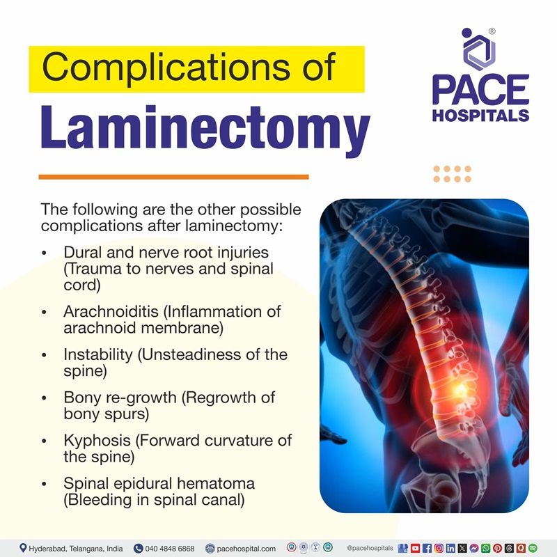 laminectomy complications | infographic showing the complications of laminectomy