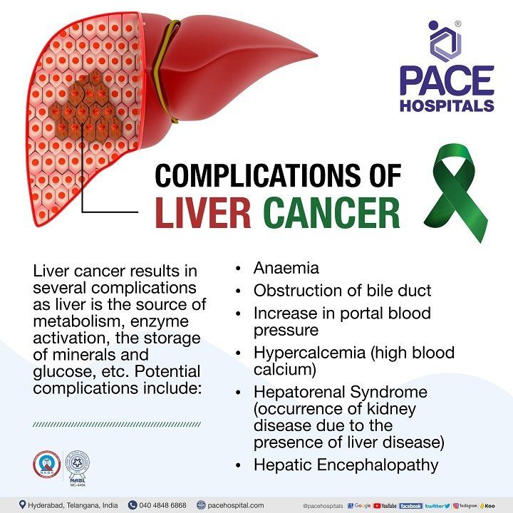 complications of liver cancer | complications of liver cancer symptoms