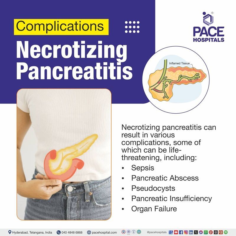 Acute necrotizing pancreatitis complications​ | Visual showing Necrotizing pancreatitis complications​