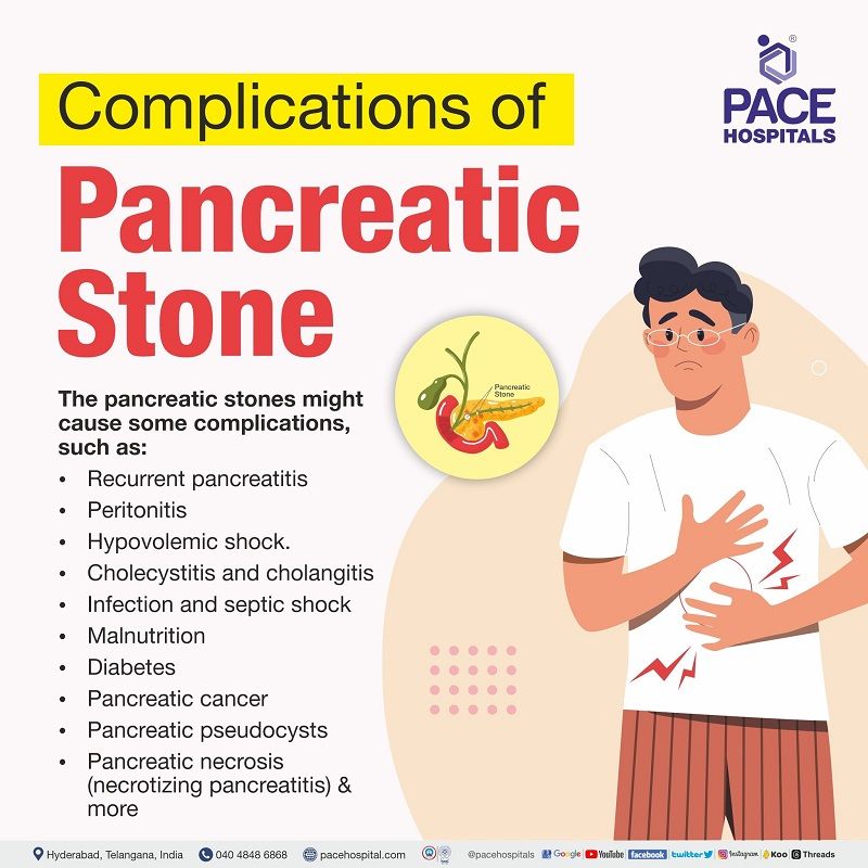 complications of pancreas stones | pancreatic stones complications | pancreatolithiasis complications | pancreatic calculi complications