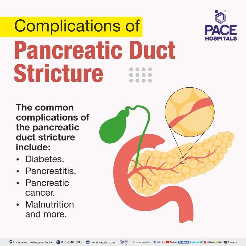 Complications of Pancreatic Duct Strictures | Benign and Malignant Pancreatic Ductal Strictures Complications