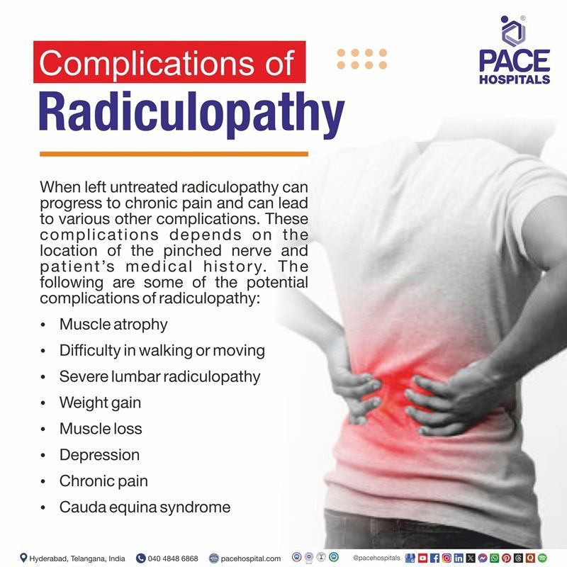 Complications of Radiculopathy Complications of cervical radiculopathy | complications of lumbar radiculopathy