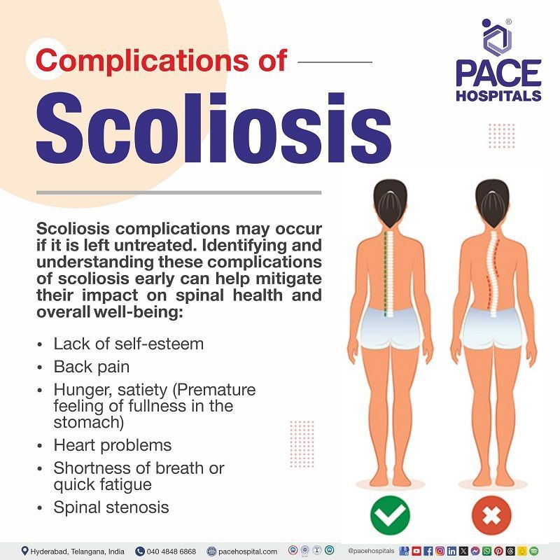 scoliosis complications | complications of Scoliosis | Visual depicting the complications of Scoliosis | Scoliosis complications in elders 
