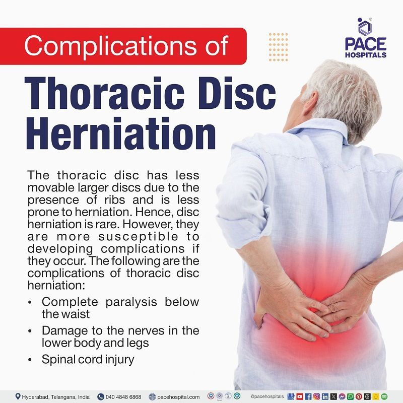 Thoracic disc  herniation complications | complications of Thoracic disc  herniation | What are the complications of Thoracic disc  herniation | visual narrating the complications of  Thoracic disc  herniation