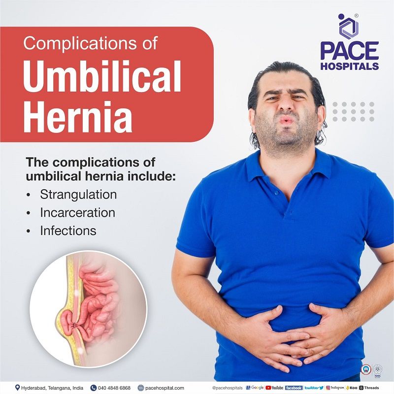 umbilical hernia complications, India | umbilical hernia risk | umbilical hernia strangulation risk | chances of umbilical hernia strangulation | umbilical hernia problems