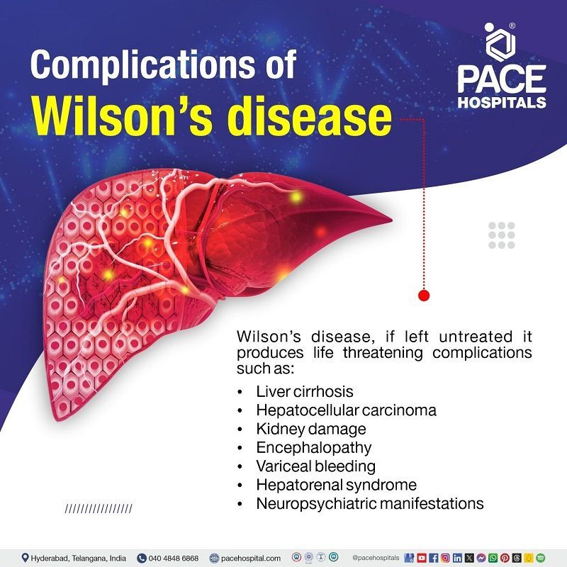 Complications of Wilson's Disease | Wilson's Disease Complications | What are the complications of Wilson's Disease | Visual explaining the Complications of Wilson's Disease 