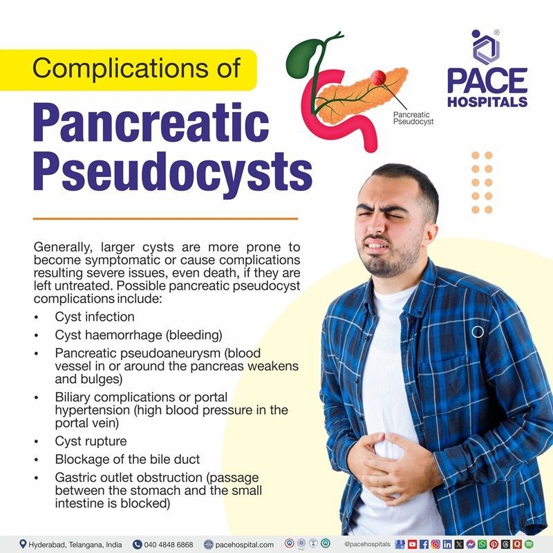 pancreatic pseudocyst complications​ | Visual illustrating the complications of pancreatic pseudocyst