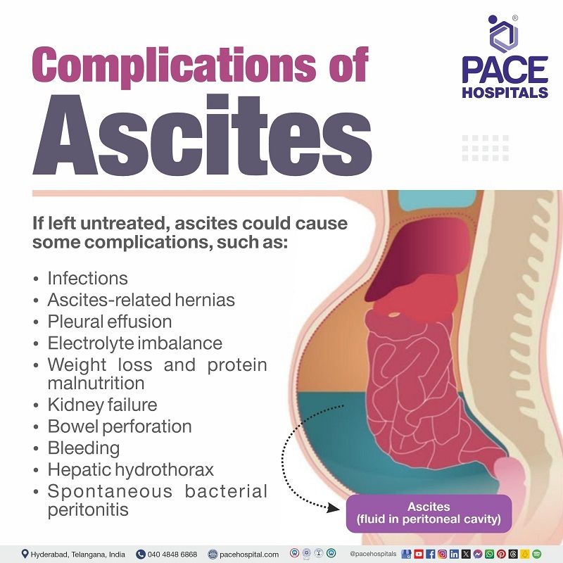 Ascites Complications | complications of ascites | types of ascites complications | What are the complications of ascites | Visual narrating the complications of Ascites