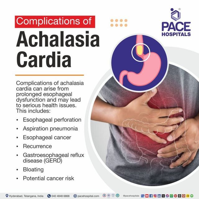 What Is Achalasia Achalasia Cardia Esophageal