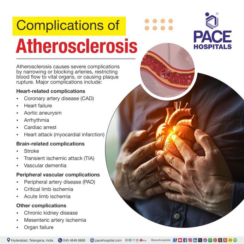 Complications of atherosclerosis | Atherosclerosis complications