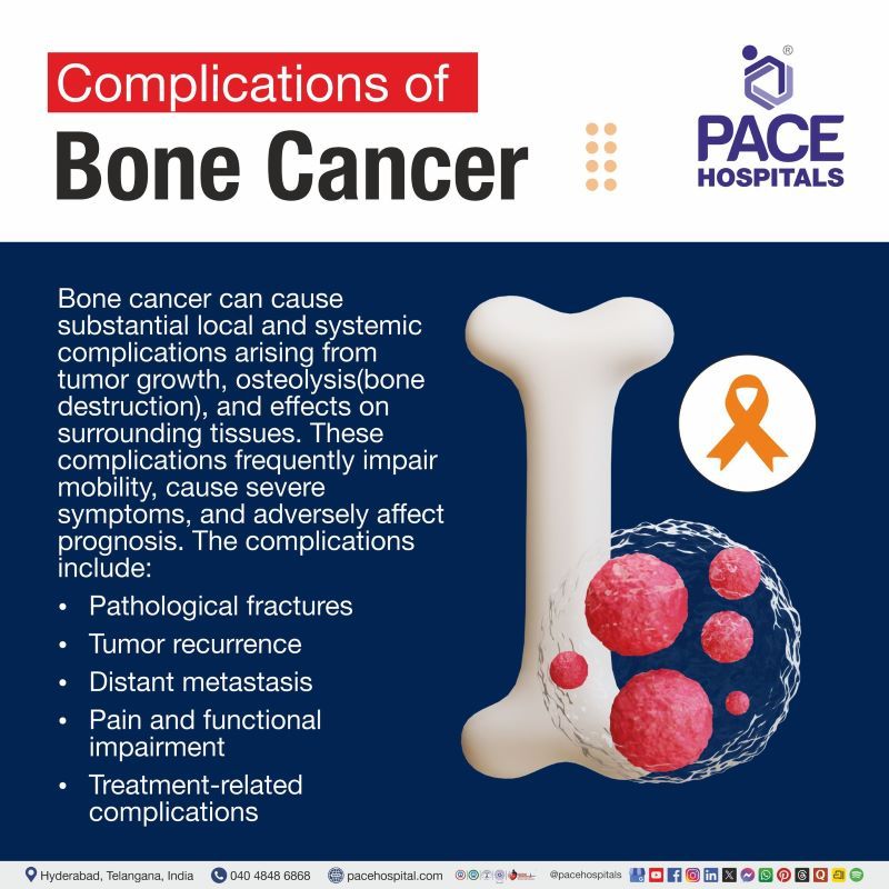 Complications of Bone Cancer Complications of Bone Cancer | Bone Cancer Complications