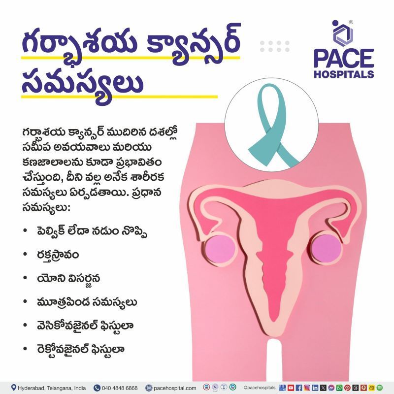 గర్భాశయ క్యాన్సర్ సమస్యలు | Complications of Cervical Cancer in Telugu Complications of Cervical Cancer in Telugu | గర్భాశయ క్యాన్సర్ సమస్యలు | Cervical Cancer Complications in Telugu