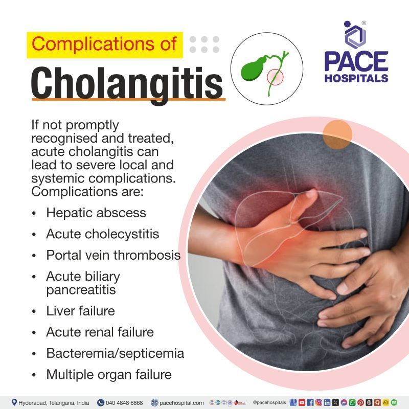 Cholangitis Complications | Complications of Cholangitis