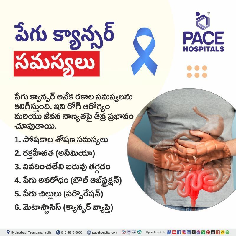 Complications of Intestinal Cancer in Telugu | పేగు క్యాన్సర్ సమస్యలు | Intestinal Cancer Complications in Telugu