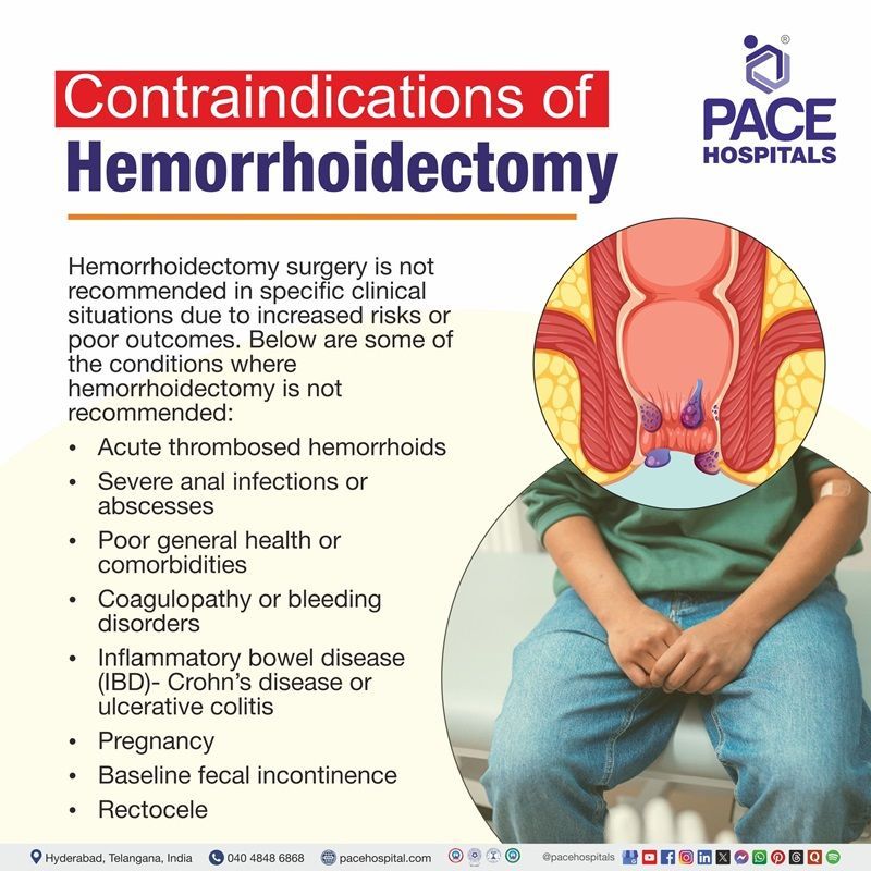 hemorrhoidectomy Contraindications​ | Contraindications​ of hemorrhoidectomy | What are the Contraindications​ of hemorrhoidectomy
