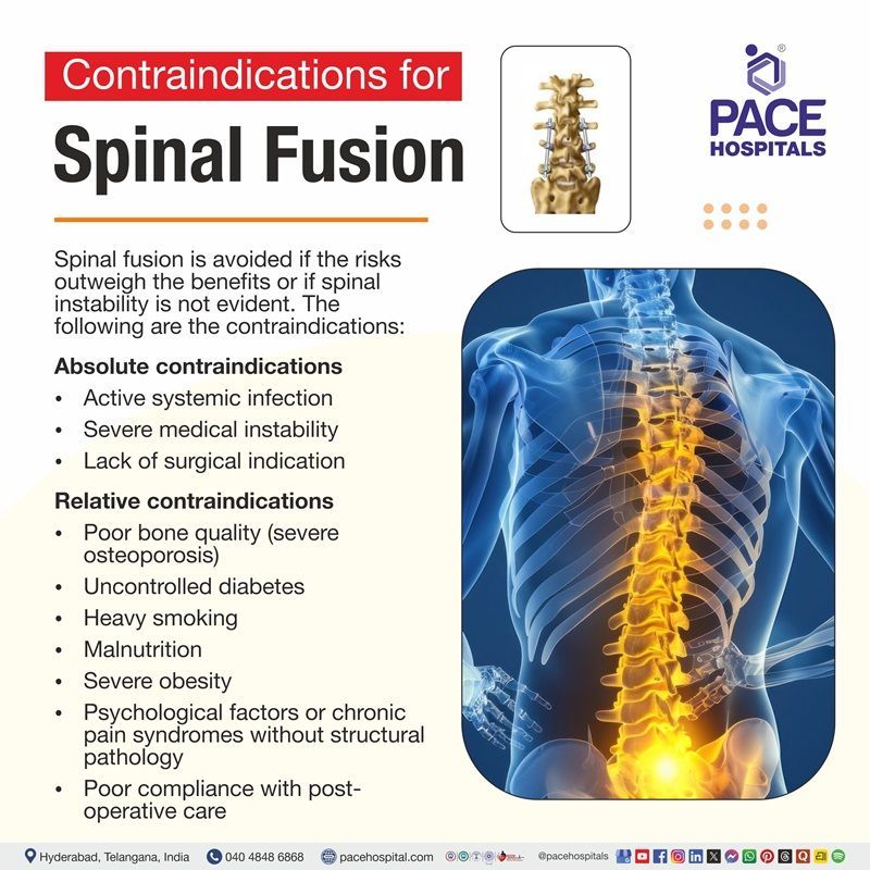 image depicting the contraindications of Spinal Fusion Surgery | Spinal Fusion Contraindications