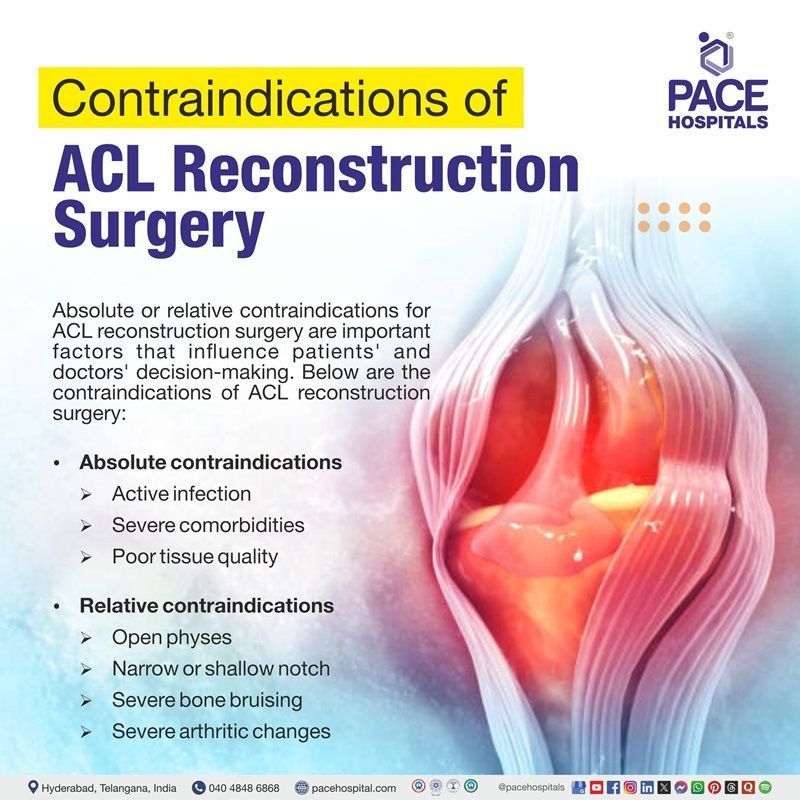 Contraindications of ACL Reconstruction ACL Reconstruction Contraindications | Contraindications ACL Reconstruction