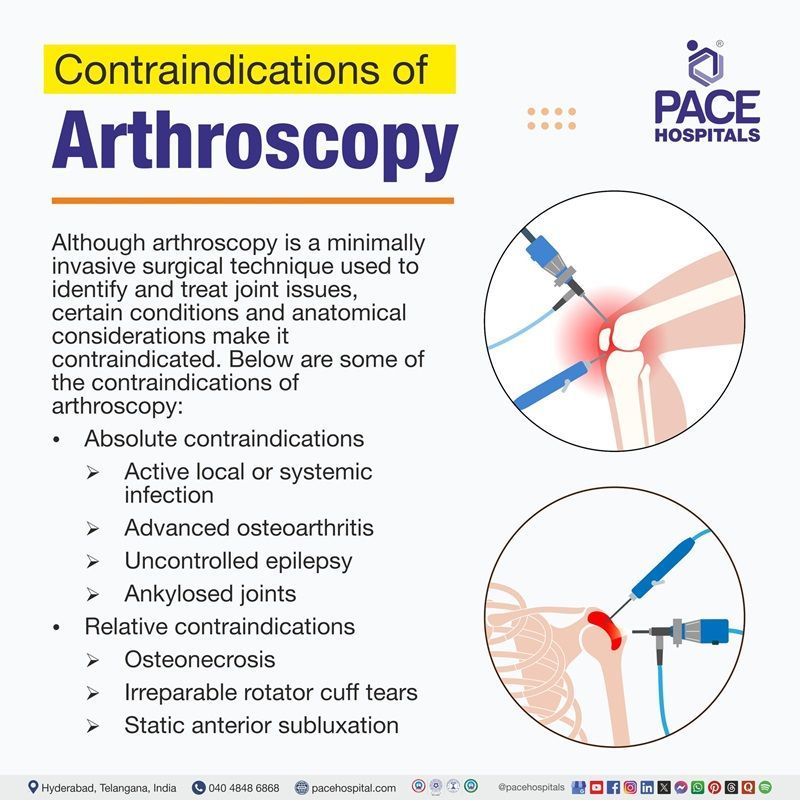 Contraindications of arthroscopy​ | arthroscopy​ contraindications