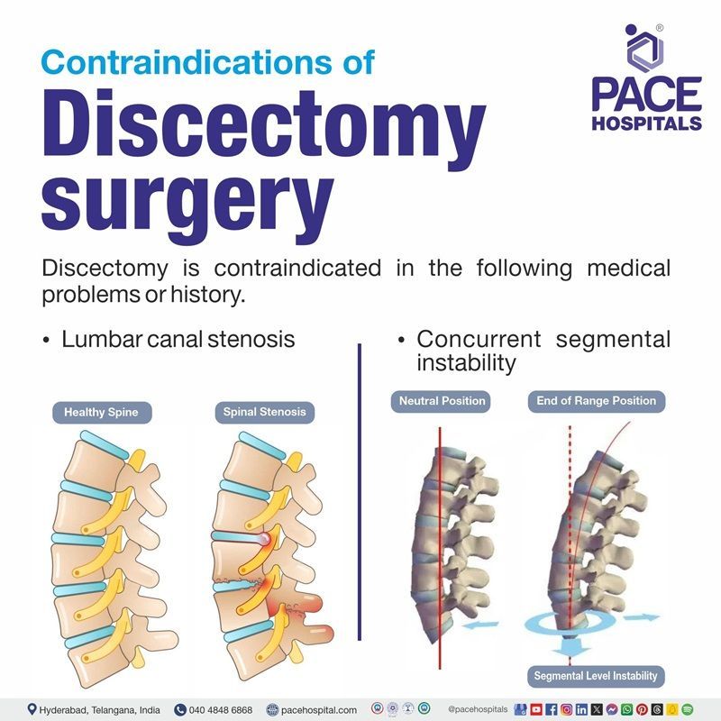 Contraindications of Discectomy surgery​ or procedure