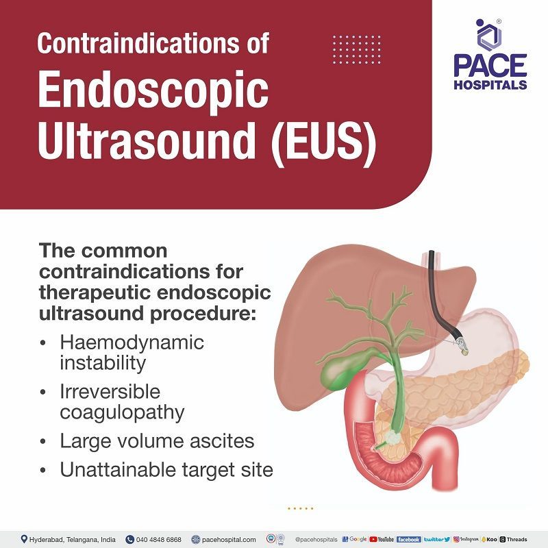EUS procedure contraindications | endoscopic ultrasound indications and contraindications