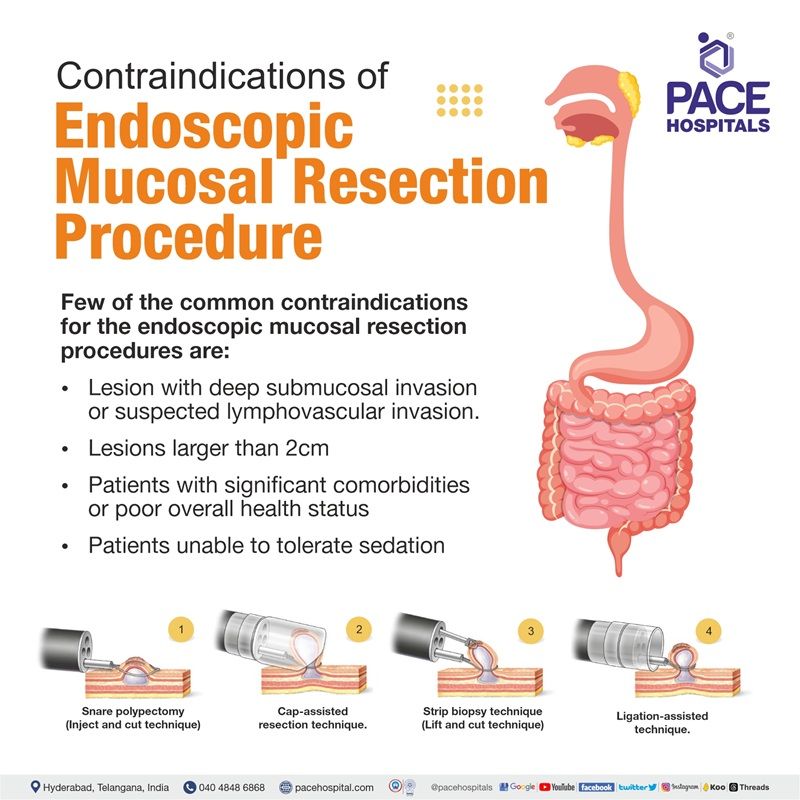 endoscopic mucosal resection technique | endoscopic mucosal resection vs polypectomy | endoscopic mucosal resection near me | endoscopic mucosal resection contraindications