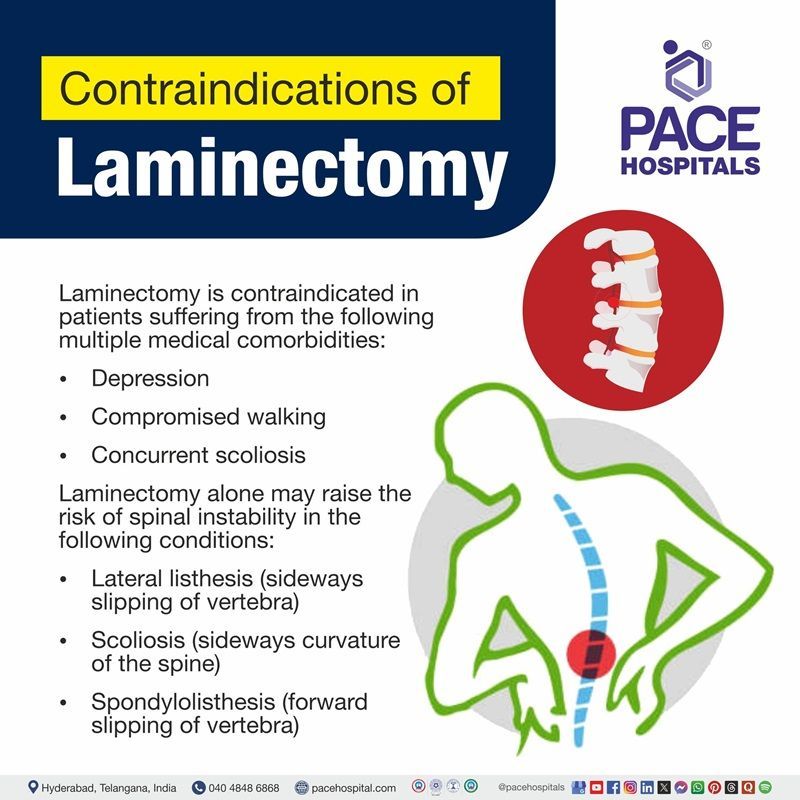 Laminectomy contraindications | Visual depicting the contraindications of laminectomy