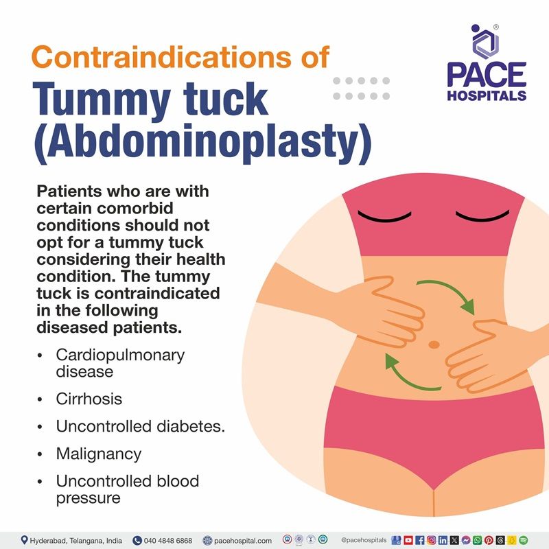 Contraindications of Abdominoplasty | Tummy tuck Contraindications | What are the contraindications of abdominoplasty | Contraindications of Tummy tuck | Visual depicting the contraindications of Tummy tuck 