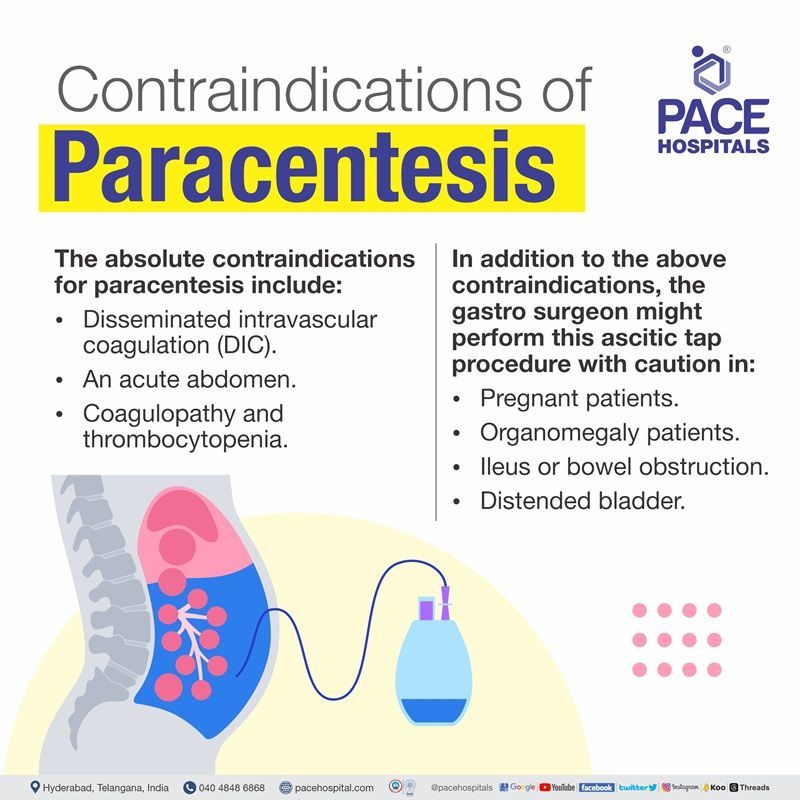 paracentesis contraindications | ascitic tapping contraindication | ascites tapping procedure contraindications