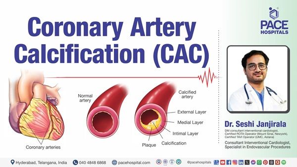 Dr. Seshi Janjirala from PACE Hospitals explains Coronary artery calcification symptoms & treatment