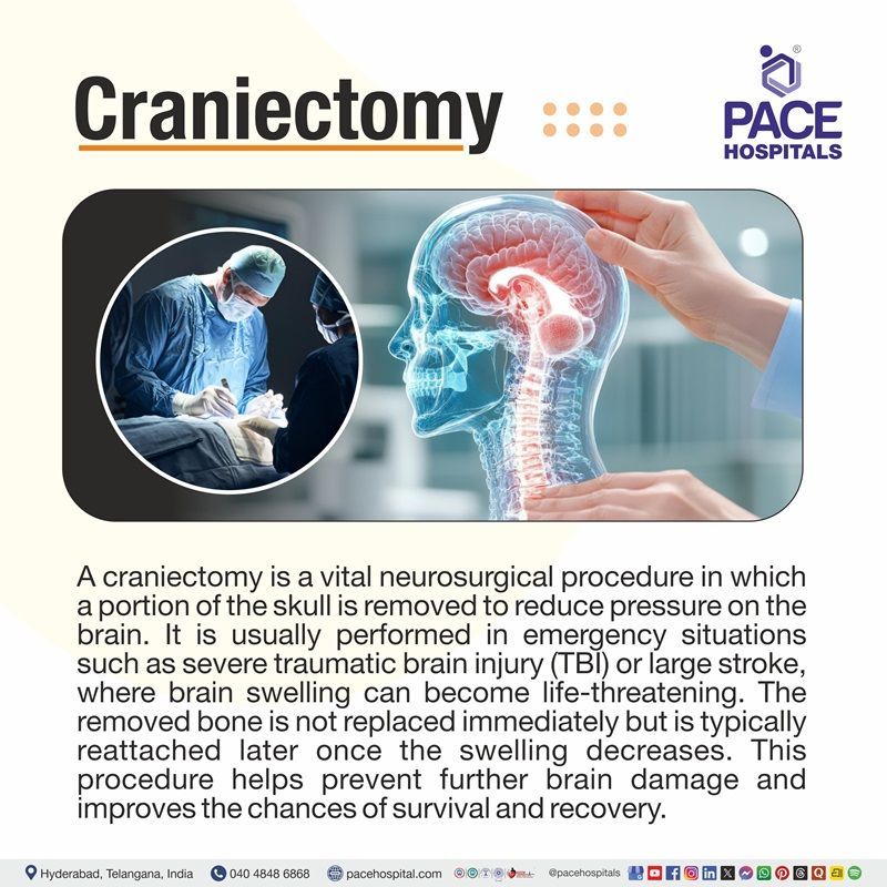 Craniectomy Meaning What is a craniectomyy | craniectomy Procedure | decompressive craniectomy