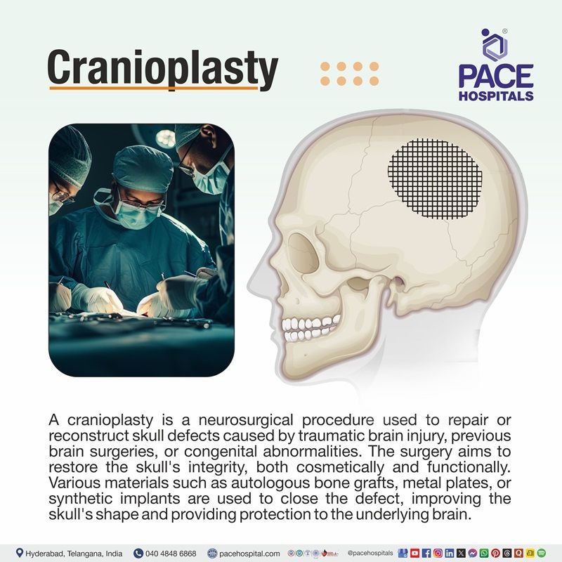 What is a Cranioplasty | Cranioplasty Procedure | Cranioplasty Surgery